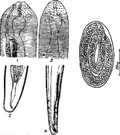 Парафилярия лошади(по Лосеву): 1 - головной конец самки; 2 - хвостовойконец самки; 3 - головной конец самца; 4 - хвостовой конец самца.